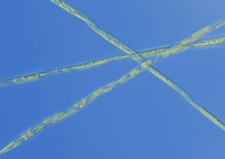 Pseudonitzschia_gallery_full_main